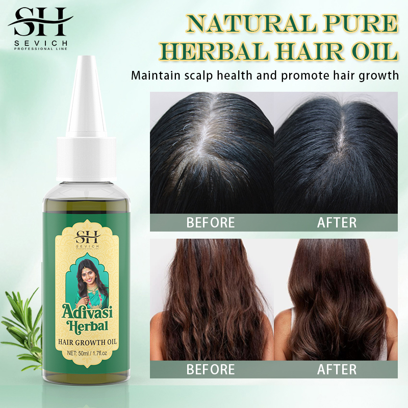 Аюрведическое масло для роста  – обзор и цена Ayurvedic & Herbal Wellness Kits